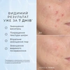 Сироватка з 10% ніацинамідом, пептидами та N-ацетилглюкозаміном