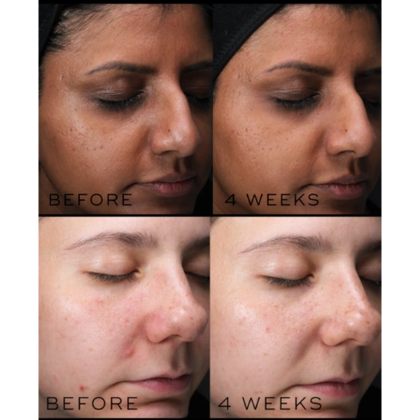 Пептидна сироватка з 10% нікотинаміду