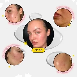 Пристрій для домашнього догляду за шкірою 6 в 1