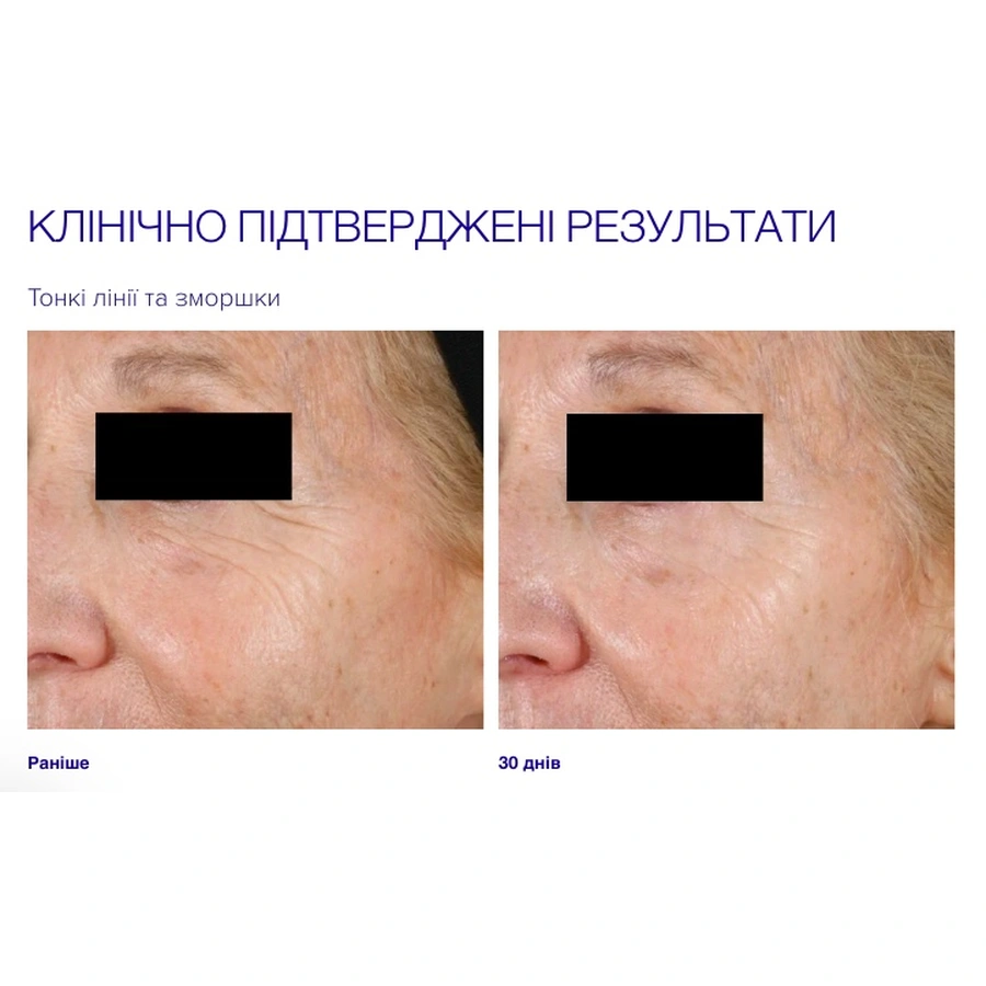 Крем для догляду за шкірою навколо очей