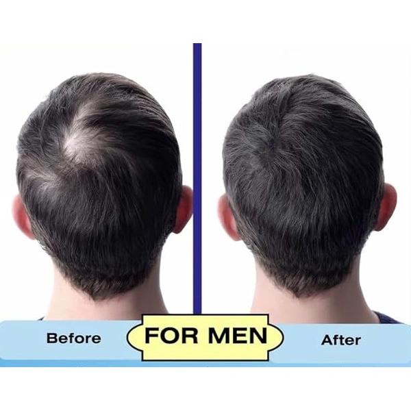 Стимулююча сироватка для росту волосся і здоров’я шкіри голови для чоловіків