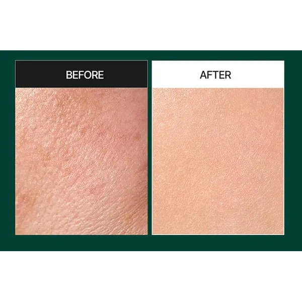 Пілінг-сироватка для обличчя зі спікулами та центелою