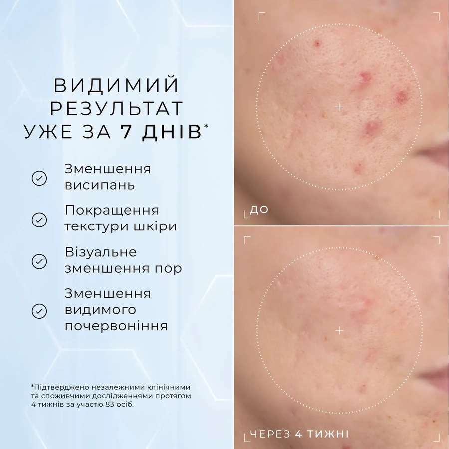 Сироватка з 10% ніацинамідом, пептидами та N-ацетилглюкозаміном