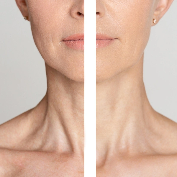 Крем для шиї з пептидним комплексом