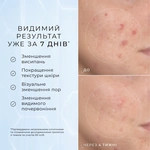 Сироватка з 10% ніацинамідом, пептидами та N-ацетилглюкозаміном