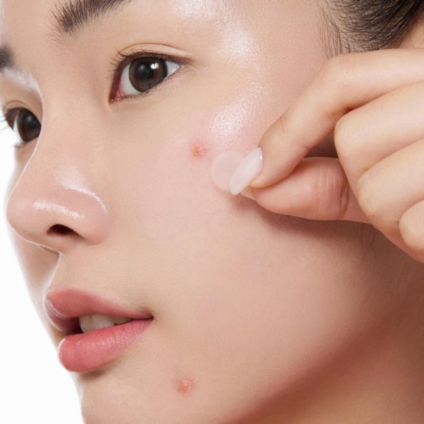 Патчі з мигдальною кислотою від висипань та постакне (39шт)