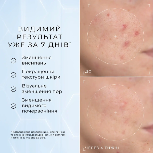 Сироватка з 10% ніацинамідом, пептидами та N-ацетилглюкозаміном
